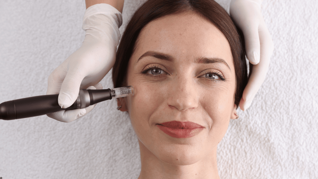 Är professionell microneedling bättre än hemmabehandling?