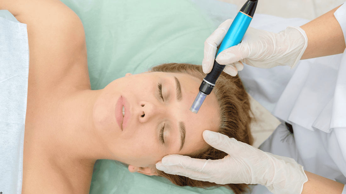 Microneedling vs kemisk peeling