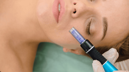 Microneedling-behandling i ansiktet med dermapen – stimulerar kollagenproduktion och förbättrar hudens struktur och lyster.