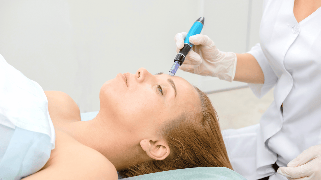 Microneedling-behandling i ansiktet med dermapen för säker hudföryngring