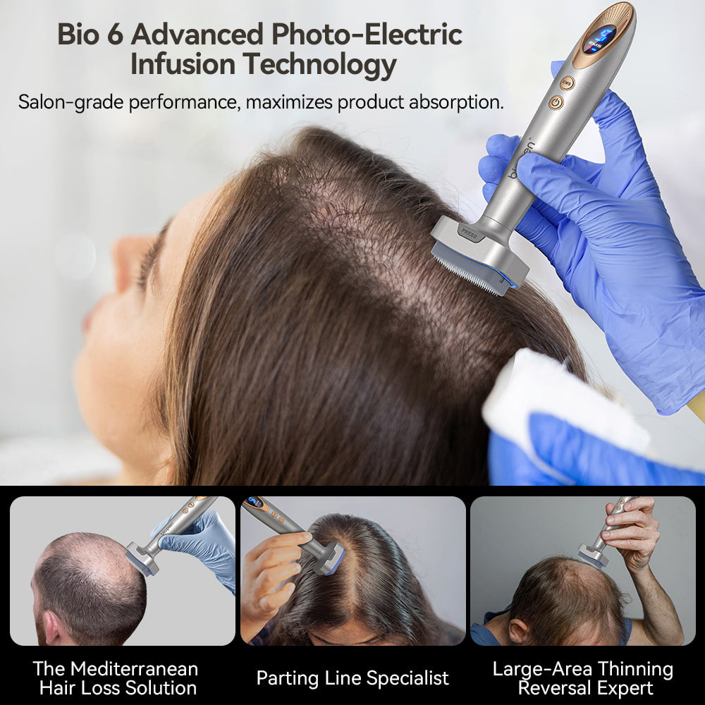 Bio Pen Bio 6 is used in the treatment of hair loss with advanced photo-electric infusion technology, demonstrating professional application to stimulate hair growth and improve product absorption on thinning areas.