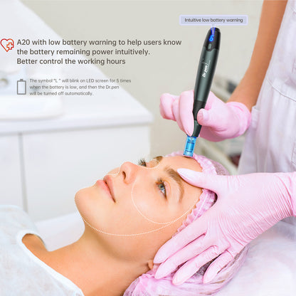 Skin therapist performing microneedling with Dr. Pen A20 on a client's forehead, with shown low battery warning and marked treatment areas for professional facial treatment.